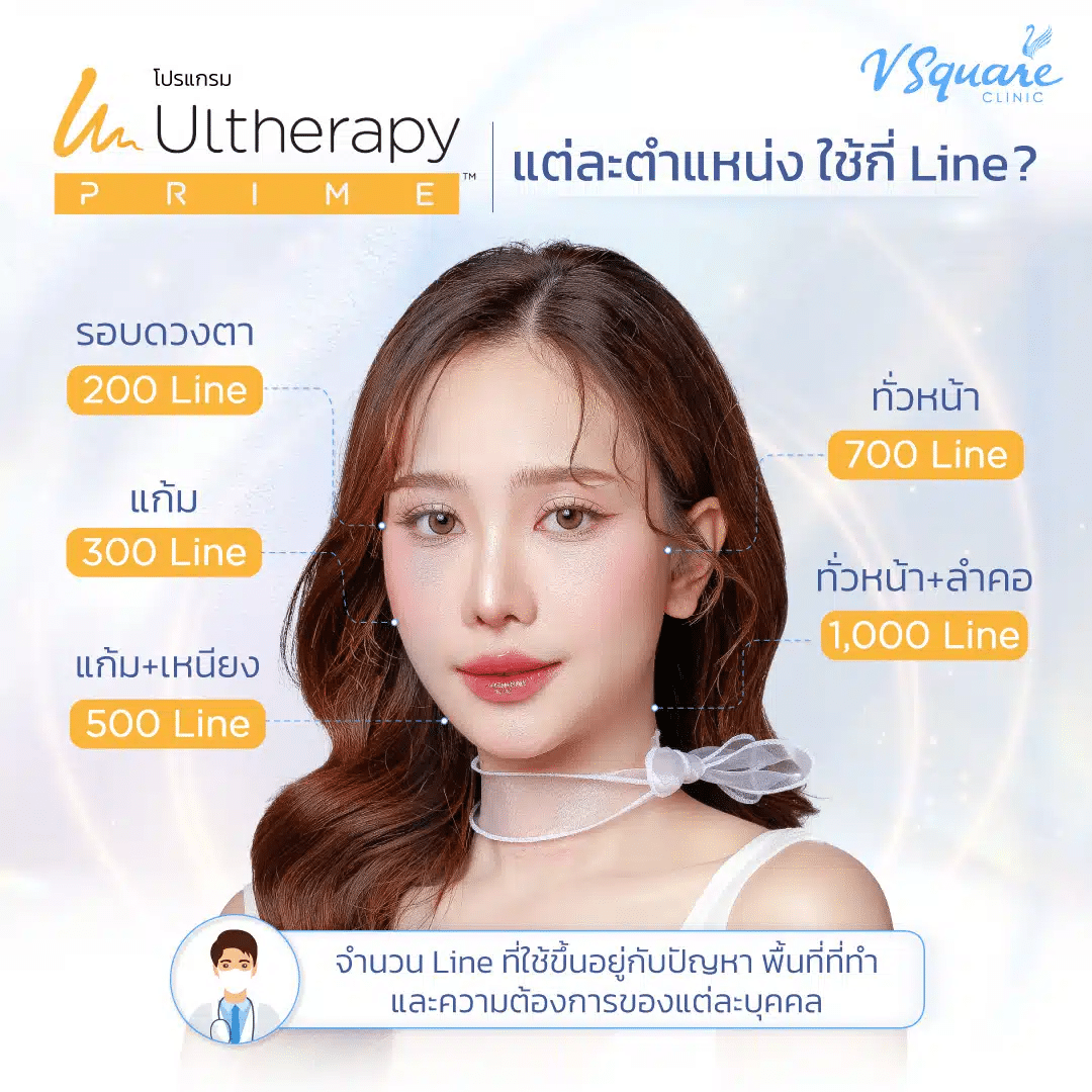 Ulthera ใช้กี่ไลน์