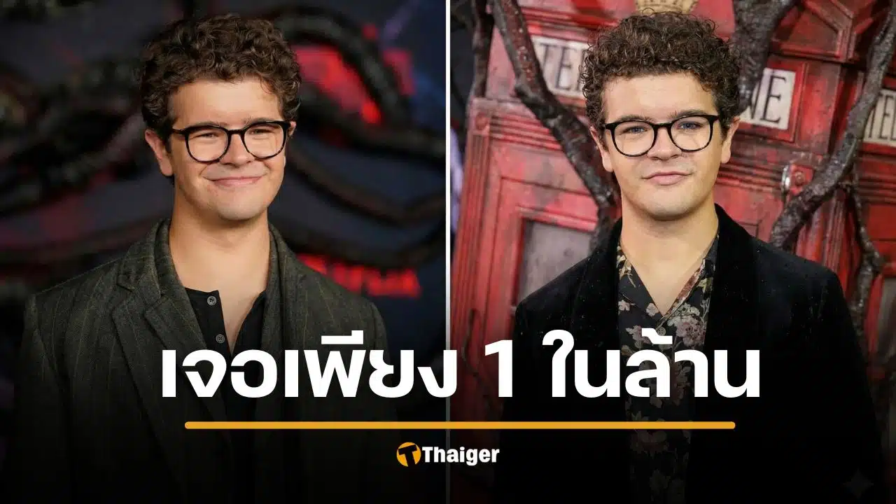 ดัสติน ดารา Stranger Things ป่วยโรคหายาก ไม่มีไหปลาร้า ตัวพับได้เหมือนสมุด