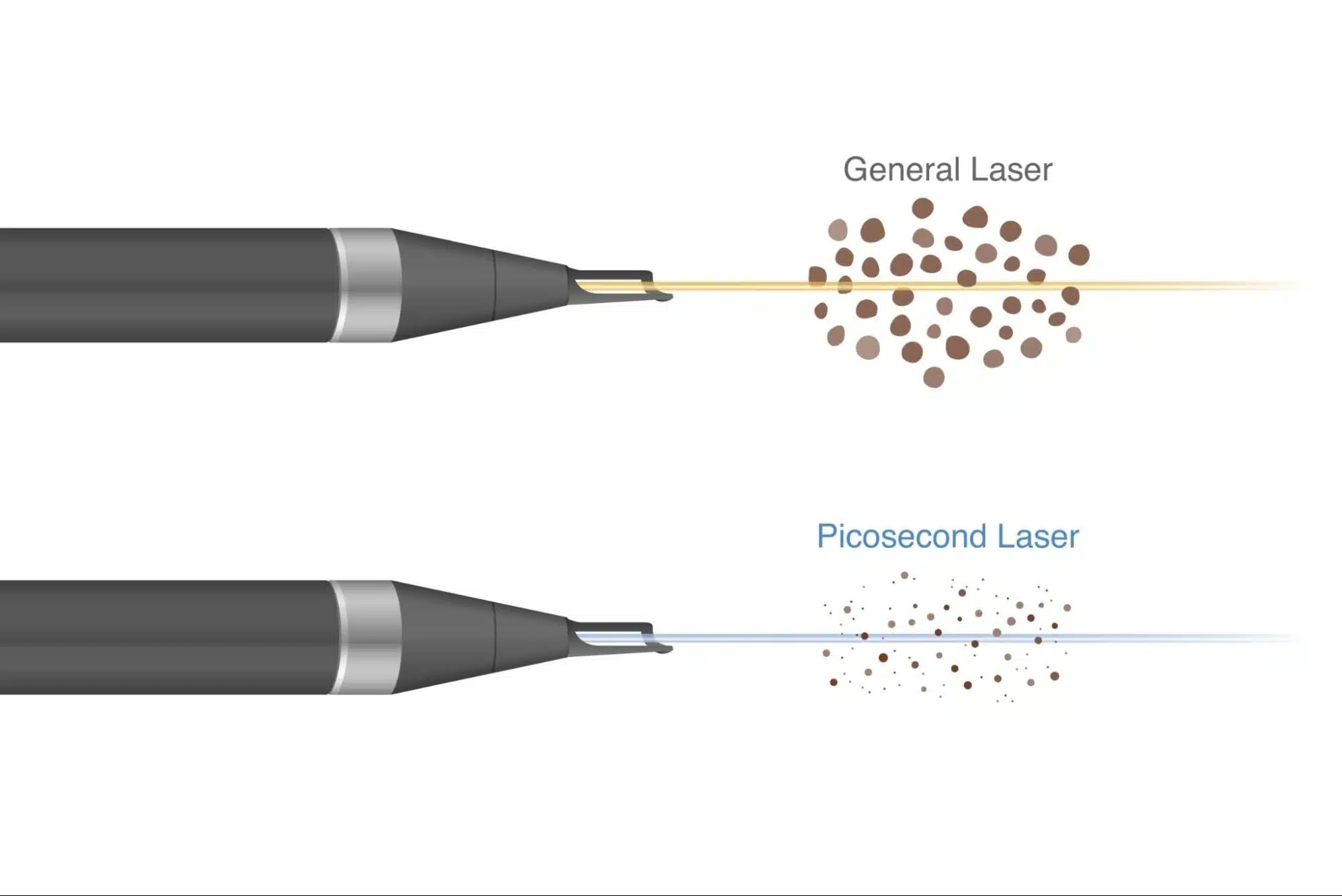 Pico Laser คืออะไร
