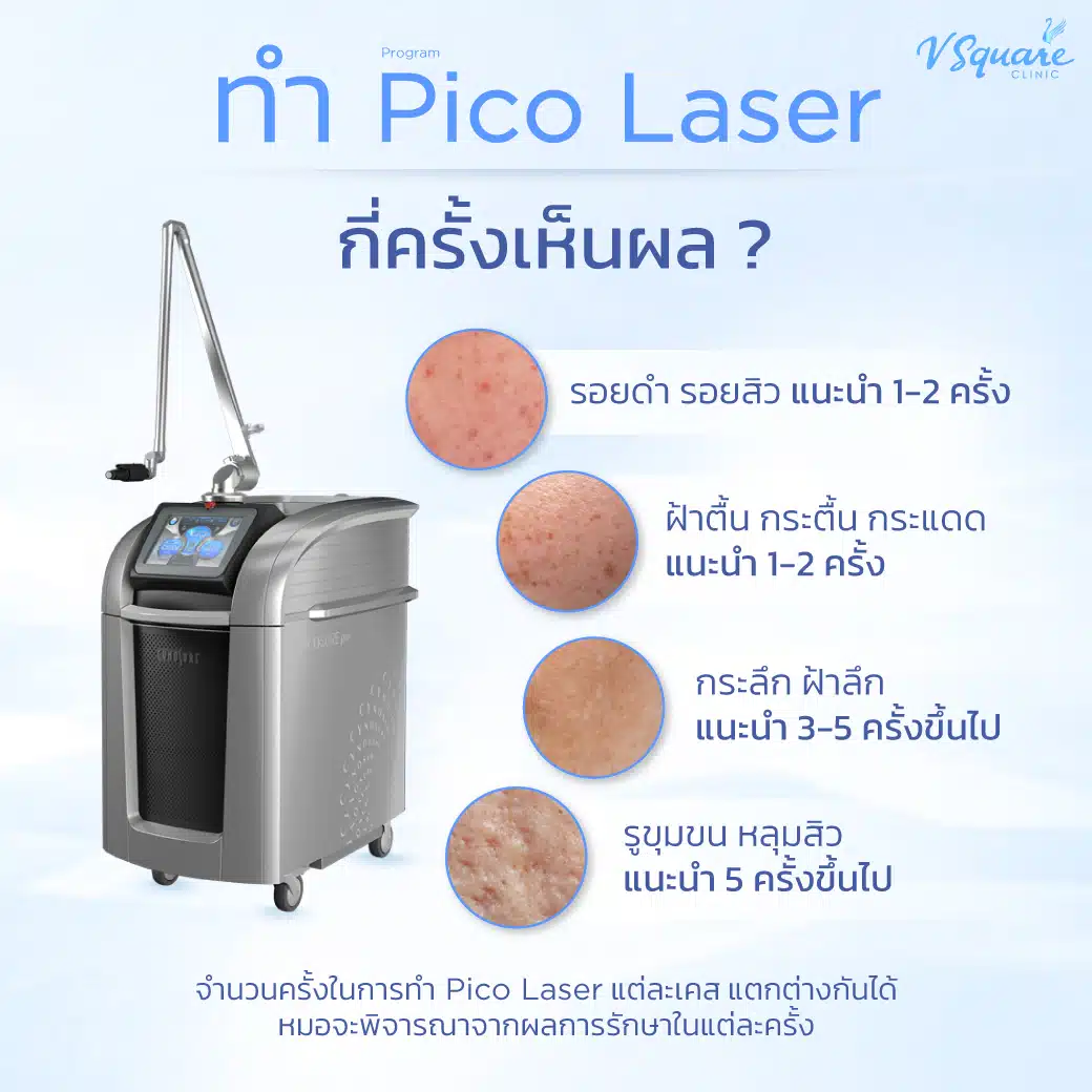 ทำ Pico Laser กี่ครั้งเห็นผล