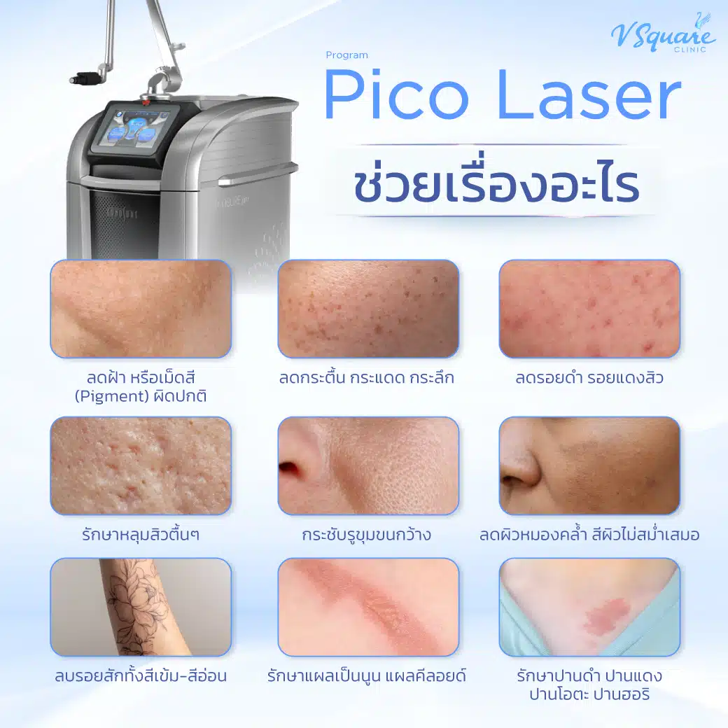 Pico Laser ช่วยเรื่องอะไร