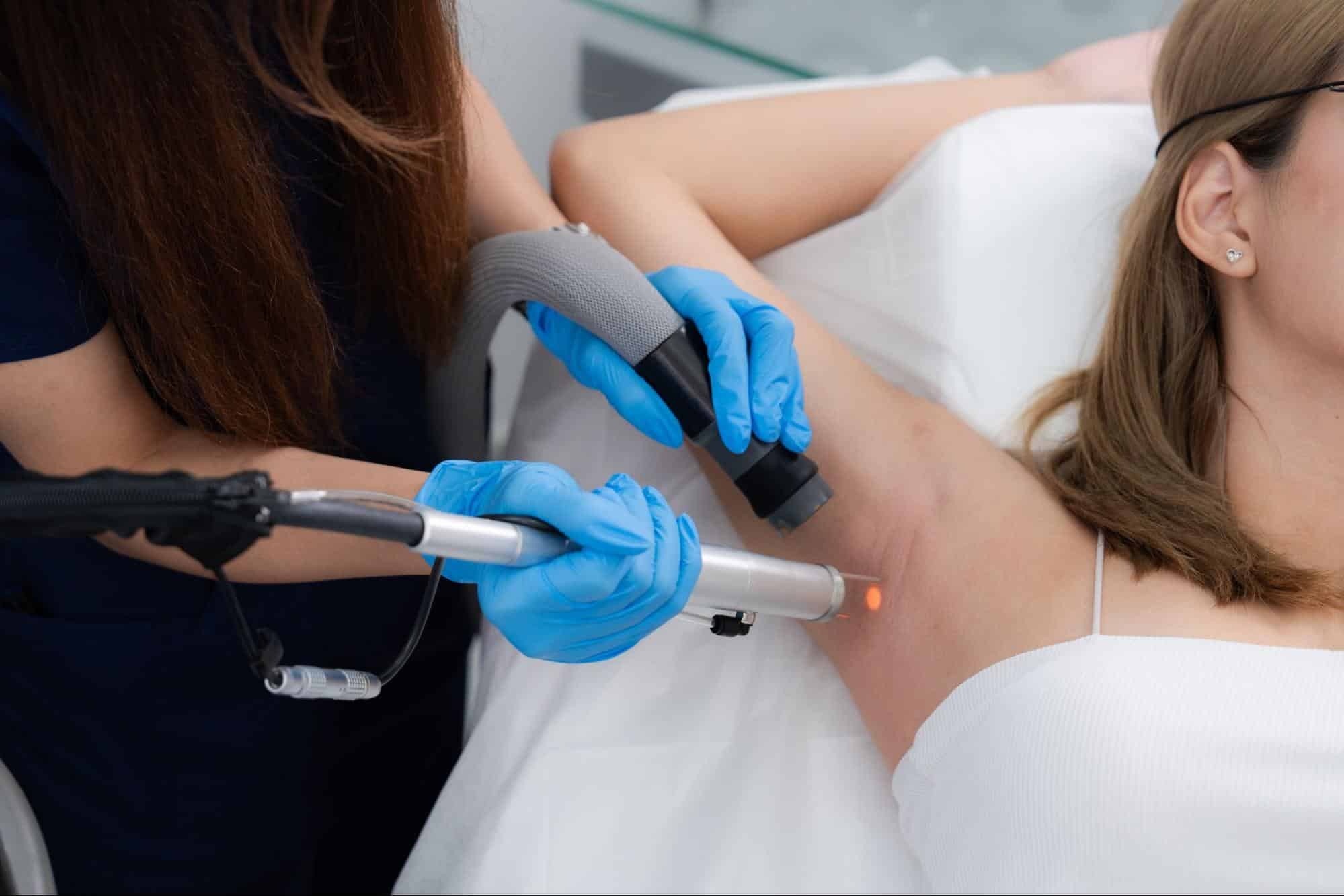 เลเซอร์รักแร้โดยนักกายภาพ