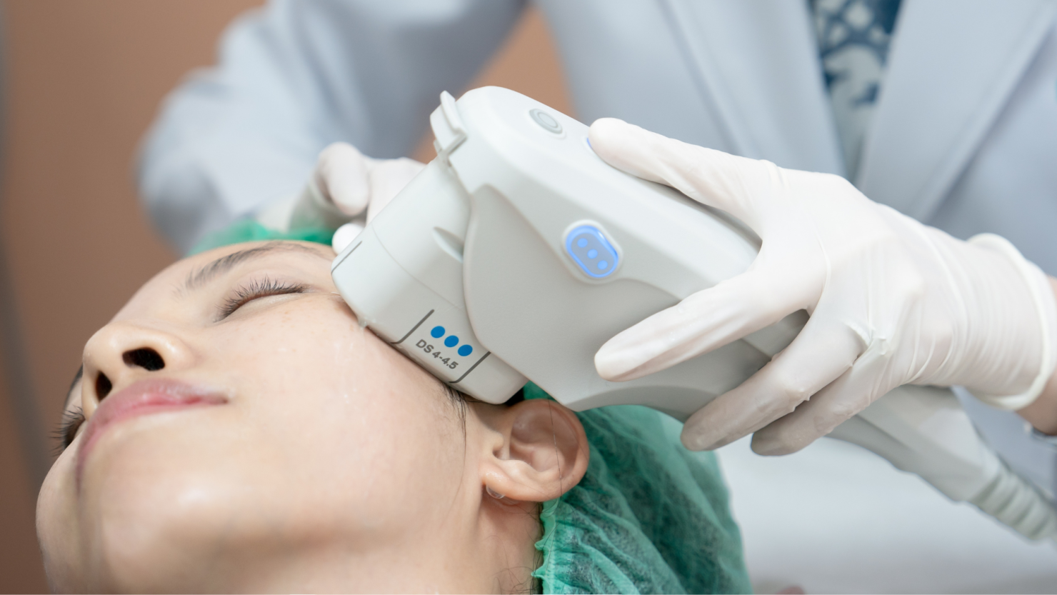 ขั้นตอนทำ Ulthera