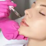 ฉีดฟิลเลอร์ปาก