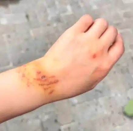 นักท่องเที่ยวจีน ถูกฉลามกัด ขณะดำน้ำที่เกาะมัลดีฟส์-3