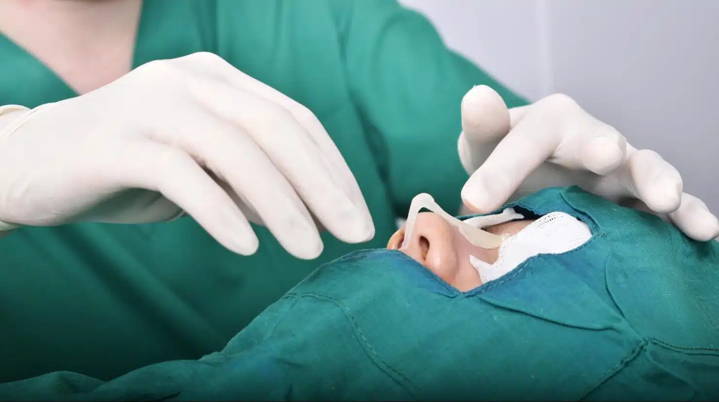 ผ่าตัดเสริมจมูก