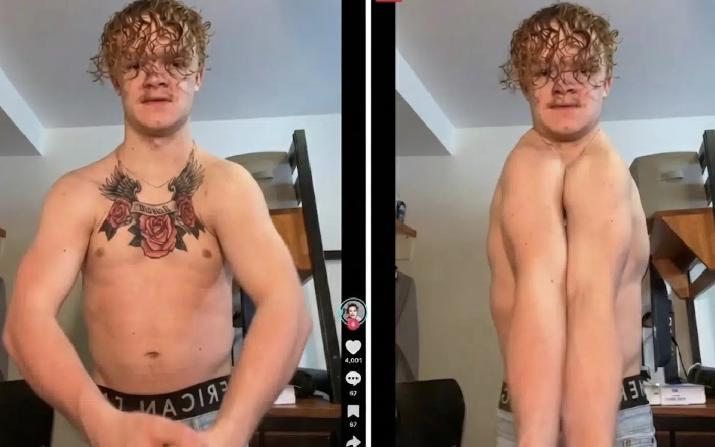 คนในรูปลื่อ coey bannett เป็น ccd เหมือนกัน