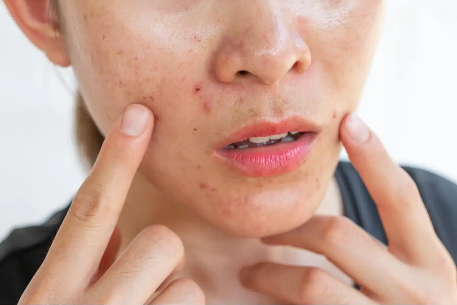 มาเด้คอลลาเจน เหมาะกับใคร