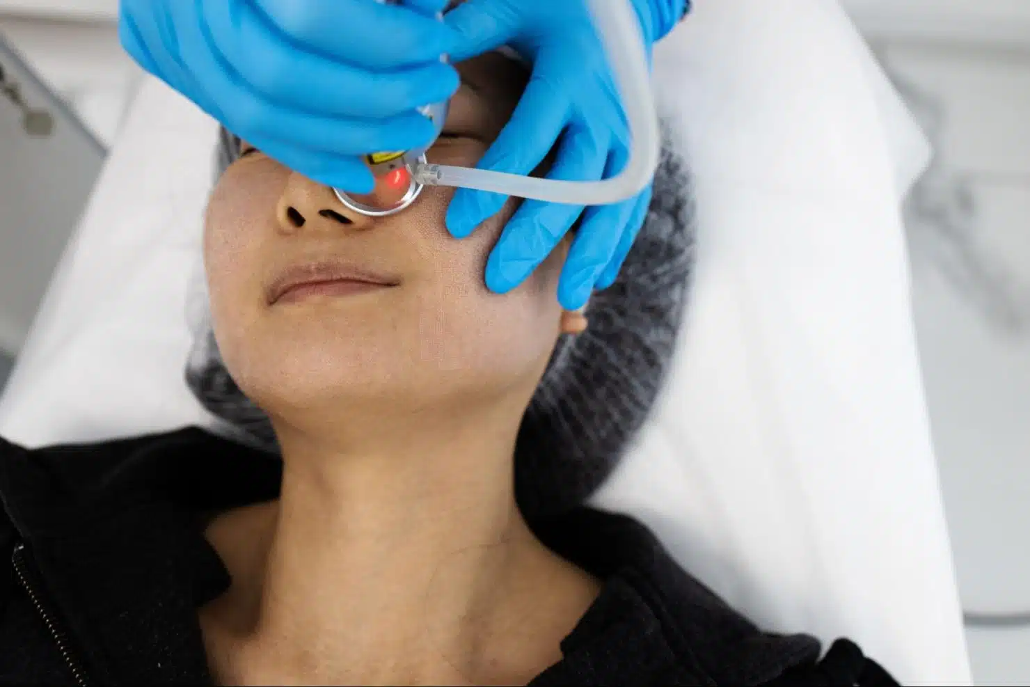 รวมวิธีรักษาหลุมสิว