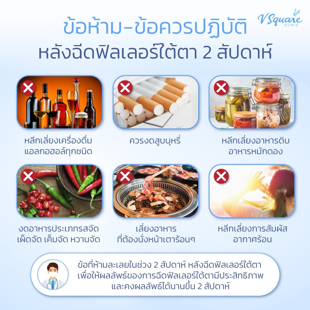 วิธีดูแลตัวเองหลังฉีดฟิลเลอร์ใต้ตา