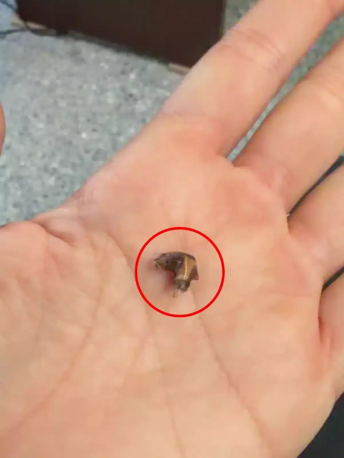 สภาพก้อนเทปกาวที่ถูกคีบออกมาจากจมูก มีลักษณะแข็งและมีหินปูนเกาะ