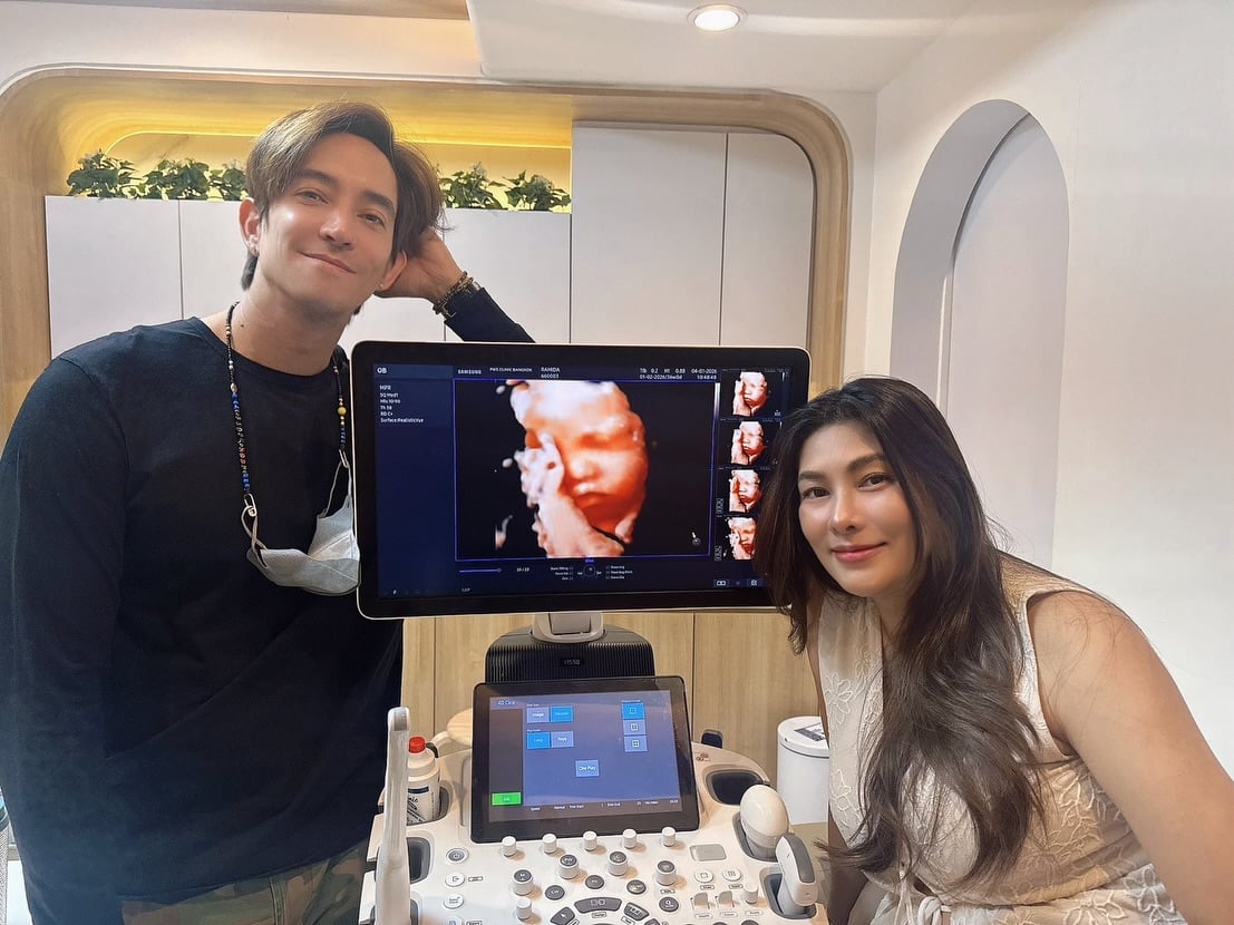 หลุยส์และนุ่นพูดถึงความหวังและความฝันในการมีลูก