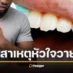 งานวิจัยยืนยัน ฟันผุ แปรงฟันไม่สะอาด ทำ "หัวใจวายเฉียบพลัน" ได้