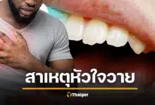 งานวิจัยยืนยัน ฟันผุ แปรงฟันไม่สะอาด ทำ "หัวใจวายเฉียบพลัน" ได้