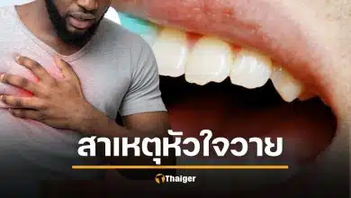 งานวิจัยยืนยัน ฟันผุ แปรงฟันไม่สะอาด ทำ "หัวใจวายเฉียบพลัน" ได้