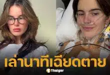 อินฟลูฯ สาววัย 24 หัวใจวายเฉียบพลัน ทั้งที่เป็นคนรักสุขภาพ สุดท้ายต้องผ่าตัดปลูกถ่ายหัวใจ