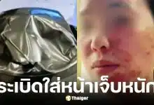 แม่บ้านจีนใช้ถ้วยสแตนเลส 2 ชั้นใส่น้ำมันเดือดจนระเบิด