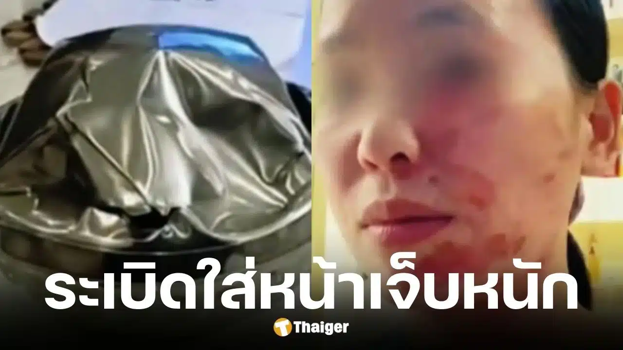 แม่บ้านจีนใช้ถ้วยสแตนเลส 2 ชั้นใส่น้ำมันเดือดจนระเบิด