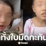 หนูน้อย 2 ขวบตาบอดกะทันหันเพราะยีนกลายพันธุ์หายาก