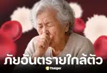 หมอมนูญเตือนภัยเงียบอาม่าวัย 84 ปอดอักเสบเป็นก้อนใหญ่