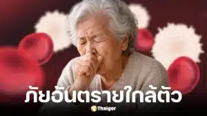 หมอมนูญเตือนภัยเงียบอาม่าวัย 84 ปอดอักเสบเป็นก้อนใหญ่