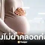 หมอม็อด ตอบแล้ว ทำไมไม่ผ่าคลอดก่อน 37 สัปดาห์