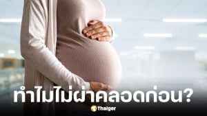 หมอม็อด ตอบแล้ว ทำไมไม่ผ่าคลอดก่อน 37 สัปดาห์