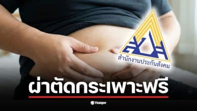 ข่าวดีมนุษย์เงินเดือน ประกันสังคม ยืนยัน ผู้ประกันตน ม.33-39 ป่วย "โรคอ้วน" ผ่าตัดกระเพาะฟรี เช็กเงื่อนไขด่วน