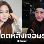 จิ๊ก เนาวรัตน์ เผยภาพล่าสุดหลังแก้หน้าพังจากพิษศัลยกรรม