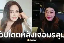 จิ๊ก เนาวรัตน์ เผยภาพล่าสุดหลังแก้หน้าพังจากพิษศัลยกรรม