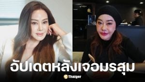 จิ๊ก เนาวรัตน์ เผยภาพล่าสุดหลังแก้หน้าพังจากพิษศัลยกรรม