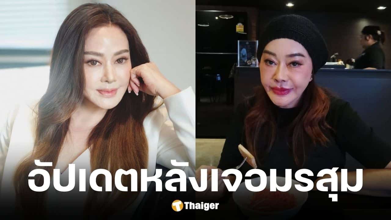 จิ๊ก เนาวรัตน์ เผยภาพล่าสุดหลังแก้หน้าพังจากพิษศัลยกรรม