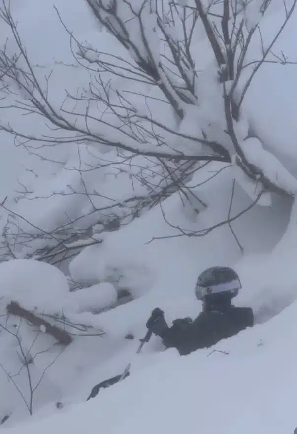 อั๋น ภูวนาท เล่นสกีไถลตกเขา