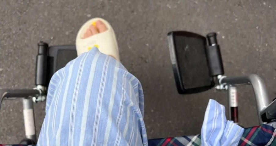 เสี่ยว ซื่อเว่ย ตัดขารักษาชีวิต