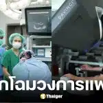 รพ.ธรรมศาสตร์ ใช้หุ่นยนต์ Da Vinci XI ช่วยผ่าตัดหัวใจสำเร็จครั้งแรกในไทย