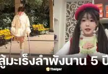 เน็ตไอดอลสาวป่วยมะเร็งยอมตัดขาแลกชีวิต