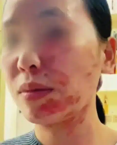 หญิงจีนหน้าพังเพระาเทน้ำมันใส่ภาชนะนี้