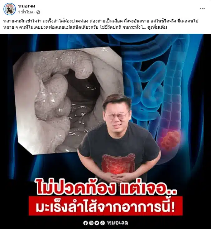 โพสต์ของ หมอเจด