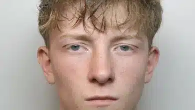 นักโทษคดีข่มขืนสาดน้ำเดือด ลวกของลับเพื่อนร่วมคุก เนื้อหลุดล่อนสยอง