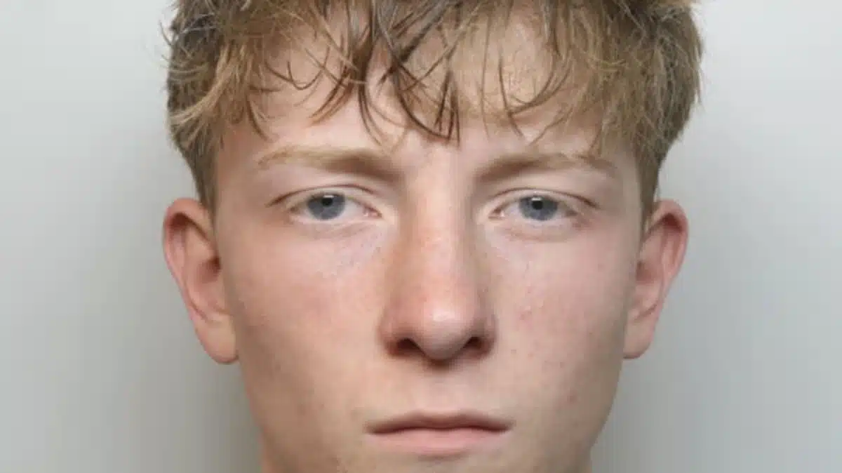 นักโทษคดีข่มขืนสาดน้ำเดือด ลวกของลับเพื่อนร่วมคุก เนื้อหลุดล่อนสยอง