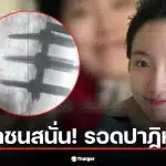 คุณหมอเจ้าของโพสต์ที่แชร์ประสบการณ์อุบัติเหตุเพื่อเป็นอุทาหรณ์