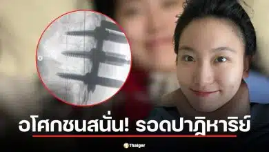 คุณหมอเจ้าของโพสต์ที่แชร์ประสบการณ์อุบัติเหตุเพื่อเป็นอุทาหรณ์