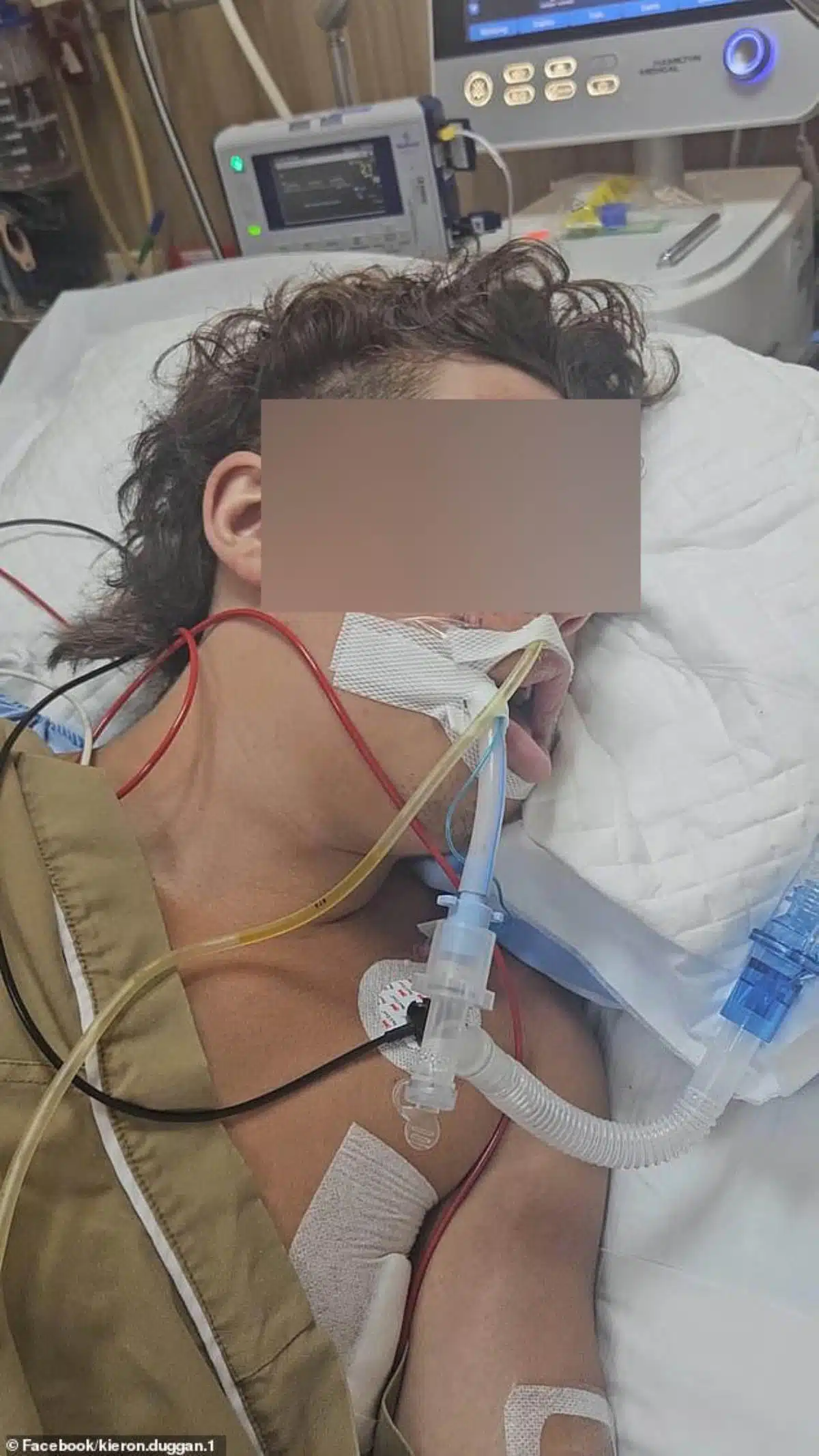 ค่าใช้จ่ายที่สูงลิ่วจากการไม่มีประกัน: ครอบครัวระดมทุนได้ 80,000 ปอนด์ หลังบริษัทประกันปฏิเสธจ่ายค่าเสียหายจากอุบัติเหตุในประเทศไทย