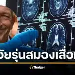 อายุ 20 ก็เสี่ยง "สมองเสื่อม" หมอเตือนคนรุ่นใหม่ เช็ก 3 สัญญาณเตือน คนมองข้าม