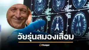 อายุ 20 ก็เสี่ยง "สมองเสื่อม" หมอเตือนคนรุ่นใหม่ เช็ก 3 สัญญาณเตือน คนมองข้าม