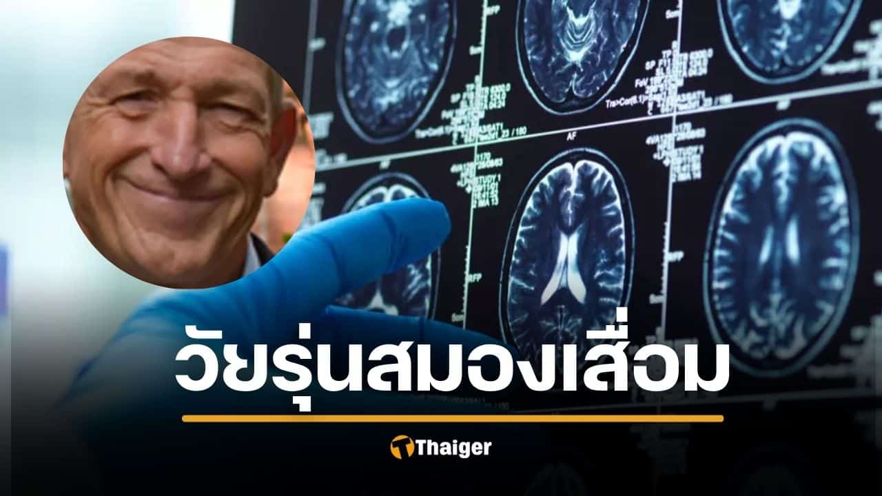 อายุ 20 ก็เสี่ยง "สมองเสื่อม" หมอเตือนคนรุ่นใหม่ เช็ก 3 สัญญาณเตือน คนมองข้าม