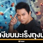 หมอเจด เตือนภัยเงียบ "มะเร็งถุงน้ำดี" ยกเคส "จา พนม" แนะสังเกต 4 อาการเสี่ยง