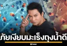 หมอเจด เตือนภัยเงียบ "มะเร็งถุงน้ำดี" ยกเคส "จา พนม" แนะสังเกต 4 อาการเสี่ยง