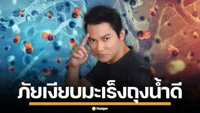 หมอเจด เตือนภัยเงียบ "มะเร็งถุงน้ำดี" ยกเคส "จา พนม" แนะสังเกต 4 อาการเสี่ยง