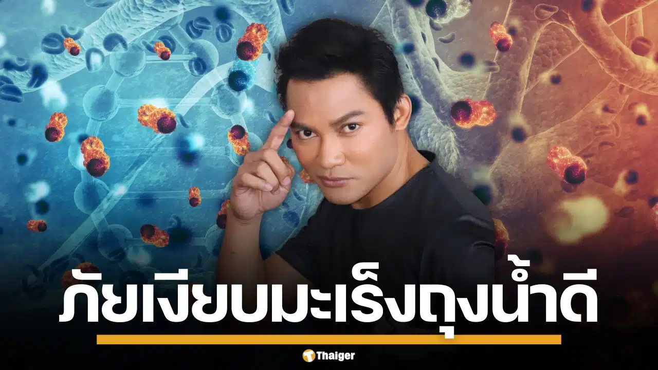 หมอเจด เตือนภัยเงียบ "มะเร็งถุงน้ำดี" ยกเคส "จา พนม" แนะสังเกต 4 อาการเสี่ยง